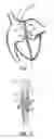 Fig. 02 - Septal closure device with centering mechanism