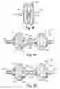 Fig. 09 - Septal closure device with centering mechanism