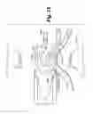 Fig. 14 - Method and apparatus for tissue fastening