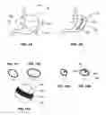 Fig. 02 - Methods for reducing gastric volume