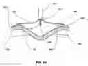 Fig. 08 - Methods for reducing gastric volume