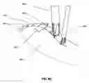 Fig. 14 - Methods for reducing gastric volume