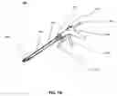 Fig. 15 - Methods for reducing gastric volume