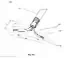 Fig. 17 - Methods for reducing gastric volume