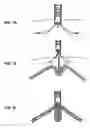 Fig. 18 - Methods for reducing gastric volume