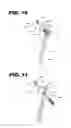 Fig. 07 - Methods and Instruments of Reducing a Fracture