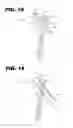 Fig. 09 - Methods and Instruments of Reducing a Fracture