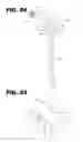 Fig. 15 - Methods and Instruments of Reducing a Fracture