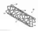Fig. 01 - STENTS WITH DRUG RESERVOIR LAYER AND METHODS OF MAKING AND USING THE SAME