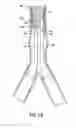 Fig. 11 - Stent/Graft Assembly