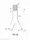 Fig. 14 - Stent/Graft Assembly