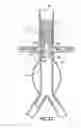 Fig. 17 - Stent/Graft Assembly