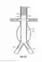 Fig. 19 - Stent/Graft Assembly