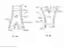 Fig. 32 - Stent/Graft Assembly