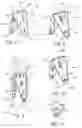 Fig. 04 - Prosthetic valve that permits retrograde flow