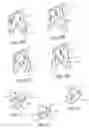 Fig. 08 - Prosthetic valve that permits retrograde flow