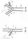 Fig. 02 - Bifurcated Stent Assembly