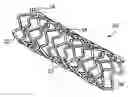 Fig. 01 - Stents with ceramic drug reservoir layer and methods of making and using the same
