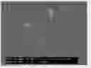 Fig. 01 - Reinforced porous coating