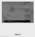 Fig. 05 - Reinforced porous coating