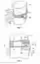 Fig. 05 - Implant restraint device and methods