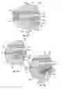 Fig. 08 - Implant restraint device and methods