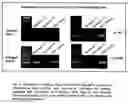 Fig. 06 - Method for the production of intervertebral disk cell transplants and their use as transplantation material