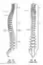 Fig. 02 - Vertebral defect device