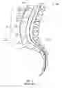 Fig. 03 - Vertebral defect device