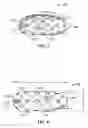 Fig. 06 - Vertebral defect device