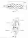 Fig. 09 - Vertebral defect device
