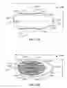 Fig. 11 - Vertebral defect device
