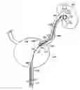 Fig. 01 - Self-retaining stent