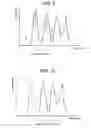 Fig. 07 - Method and apparatus for chromatographic data processing