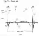 Fig. 03 - Multi-mode acceleration-based athleticism measurement system