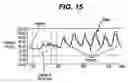 Fig. 12 - Gui With Trend Analysis for an Implantable Restriction Device and a Data Logger