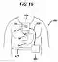 Fig. 13 - Gui With Trend Analysis for an Implantable Restriction Device and a Data Logger