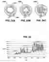 Fig. 24 - Gui With Trend Analysis for an Implantable Restriction Device and a Data Logger