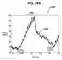 Fig. 44 - Gui With Trend Analysis for an Implantable Restriction Device and a Data Logger