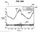 Fig. 48 - Gui With Trend Analysis for an Implantable Restriction Device and a Data Logger