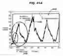 Fig. 52 - Gui With Trend Analysis for an Implantable Restriction Device and a Data Logger