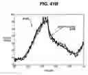Fig. 53 - Gui With Trend Analysis for an Implantable Restriction Device and a Data Logger