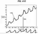 Fig. 54 - Gui With Trend Analysis for an Implantable Restriction Device and a Data Logger