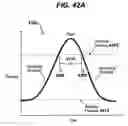 Fig. 55 - Gui With Trend Analysis for an Implantable Restriction Device and a Data Logger