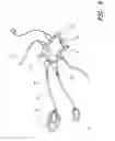 Fig. 07 - Lanyard device for children