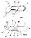 Fig. 02 - Mallet finger splint