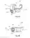Fig. 09 - Interspinous process spacers