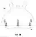 Fig. 16 - ORTHOPEDIC IMPLANT