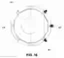 Fig. 17 - ORTHOPEDIC IMPLANT