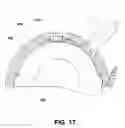Fig. 18 - ORTHOPEDIC IMPLANT